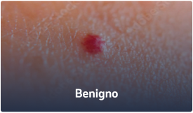 Benigno