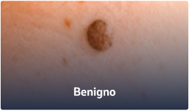 Benigno