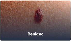 Benigno