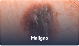 Maligno