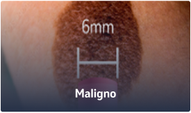 Maligno