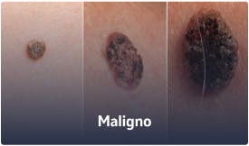 Maligno